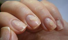 Ways to restore nails after gel polish